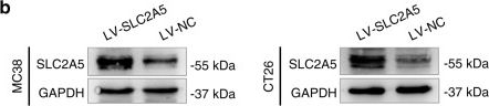Fig.3.B showing Western Blotting from the publication: S100P contributes to promoter demethylation and transcriptional activation of SLC2A5 to promote metastasis in colorectal cancer.