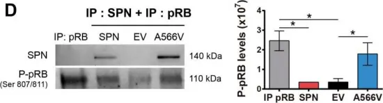 Fig.5.D showing Immunoprecipitation in a Homo sapiens (Human) sample from the publication: Mutation of SPINOPHILIN (PPP1R9B) found in human tumors promotes the tumorigenic and stemness properties of cells.