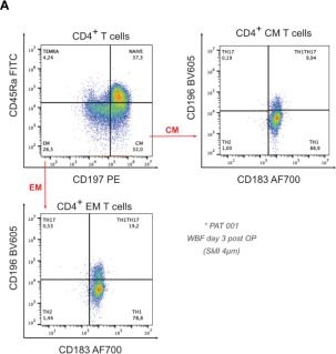 Fig.4.A showing Flow cytometry/Cell sorting in a Homo sapiens (Human) sample from the publication: Silicone implant surface microtopography modulates inflammation and tissue repair in capsular fibrosis.