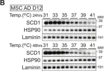 Fig.2.B showing Western Blotting from the publication: The molecular and metabolic program by which white adipocytes adapt to cool physiologic temperatures.