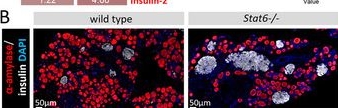 Fig.7.B showing Immunohistochemistry-immunofluorescence from the publication: IL-4/STAT6-signaling Influences Local Inflammation and Regeneration Processes During Acute Pancreatitis and Promotes Fibrosis by a Direct Activation of Pancreatic Fibroblasts During Chronic Pancreatitis.