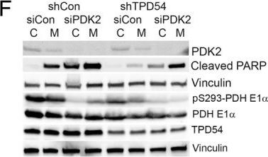 Fig.3.F showing Western Blotting in a Homo sapiens (Human) sample from the publication: The novel function of tumor protein D54 in regulating pyruvate dehydrogenase and metformin cytotoxicity in breast cancer.