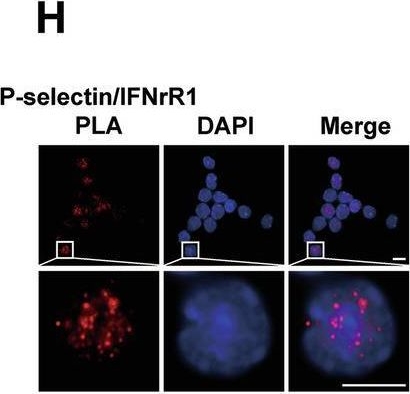Fig.6.H showing Immunocytochemistry-immunofluorescence from the publication: P-selectin overexpression impairs hematopoietic stem cell homeostasis via inflammatory receptor-mediated proliferation and differentiation.
