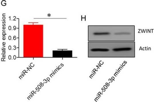 Fig.4.G showing Western Blotting in a Homo sapiens (Human) sample from the publication: Regulation of Human Lung Adenocarcinoma Cell Proliferation by LncRNA AFAP-AS1 Through the miR-508/ZWINT Axis.