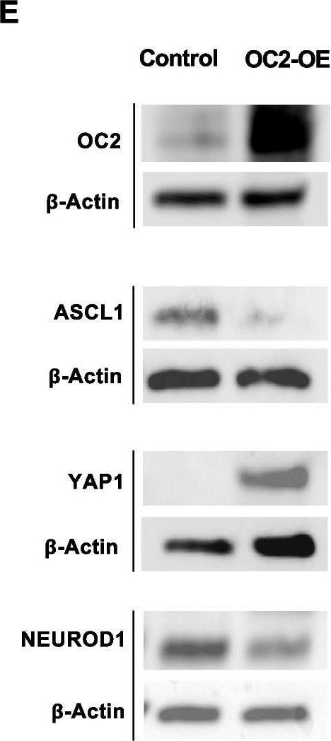 Fig.2.E showing Western Blotting in a Homo sapiens (Human) sample from the publication: ONECUT2 reprograms neuroendocrine fate and is an actionable therapeutic target in small cell lung cancer.
