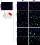 Fig.2.A showing Immunohistochemistry-immunofluorescence in a Mus musculus (House mouse) sample from the publication: Augmented Brain Infiltration and Activation of Leukocytes After Cerebral Ischemia in Type 2 Diabetic Mice.