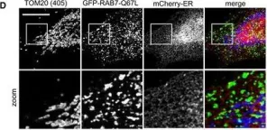 Fig.2.D showing Immunofluorescence in a Homo sapiens (Human) sample from the publication: Control of RAB7 activity and localization through the retromer-TBC1D5 complex enables RAB7-dependent mitophagy.