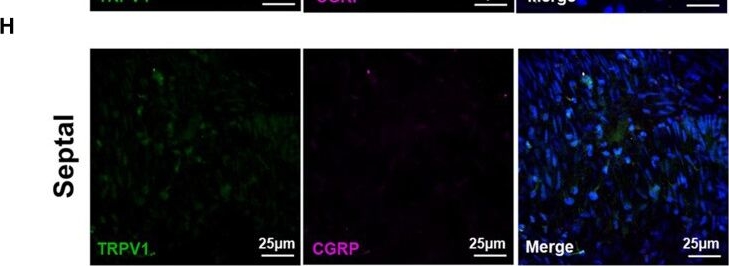 Fig.1.H showing Immunohistochemistry-immunofluorescence from the publication: Crucial role for sensory nerves and Na/H exchanger inhibition in dapagliflozin- and empagliflozin-induced arterial relaxation.