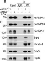 Fig.4.B showing Western Blotting from the publication: Snord15b Maintains Stemness of Intestinal Stem Cells via Enhancement of Alternative Splicing of Btrc Short Isoform for Suppression of β-Catenin Ubiquitination.