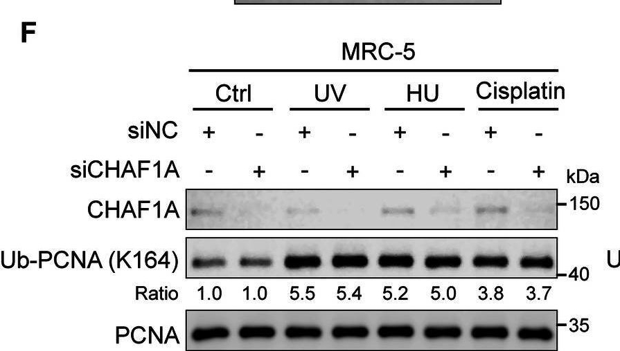 Fig.1.F showing Western Blotting in a Homo sapiens (Human) sample from the publication: Chromatin assembly factor 1 subunit A promotes TLS pathway by recruiting E3 ubiquitin ligase RAD18 in cancer cells.