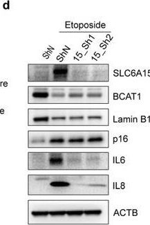 Fig.2.D showing Western Blotting in a Homo sapiens (Human) sample from the publication: Branched-Chain Amino Acid Accumulation Fuels the Senescence-Associated Secretory Phenotype.