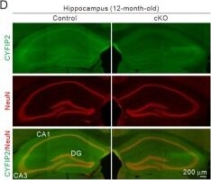 Fig.1.D showing Immunohistochemistry-immunofluorescence in a Mus musculus (House mouse) sample from the publication: Cell-autonomous reduction of CYFIP2 is insufficient to induce Alzheimer's disease-like pathologies in the hippocampal CA1 pyramidal neurons of aged mice.