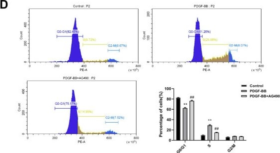 Fig.6.D showing Flow cytometry/Cell sorting from the publication: LILRB4 knockdown inhibits aortic dissection development by regulating pyroptosis and the JAK2/STAT3 signaling pathway.