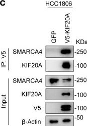 Fig.9.C showing Western Blotting in a Homo sapiens (Human) sample from the publication: Targeting kinesin family member 20A sensitizes stem-like triple-negative breast cancer cells to standard chemotherapy.