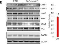 Phospho-YAP (Ser127) Antibody | Cell Signaling Technology