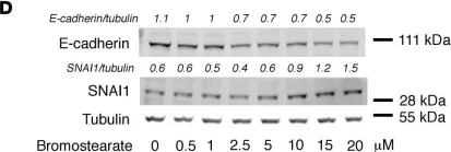 Fig.5.D showing Western Blotting from the publication: Impaired fatty acid metabolism perpetuates lipotoxicity along the transition to chronic kidney injury.