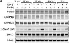 Fig.4.D showing Western Blotting from the publication: TGF-β signalling and PEG10 are mutually exclusive and inhibitory in chondrosarcoma cells.