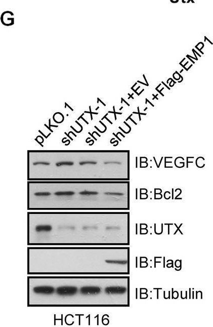 Fig.3.G showing Western Blotting in a Homo sapiens (Human) sample from the publication: CUL4B-DDB1-COP1-mediated UTX downregulation promotes colorectal cancer progression.