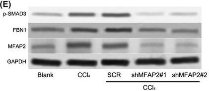 Fig.6.E showing Western Blotting in a Mus musculus (House mouse) sample from the publication: MFAP2 promotes HSCs activation through FBN1/TGF-β/Smad3 pathway.
