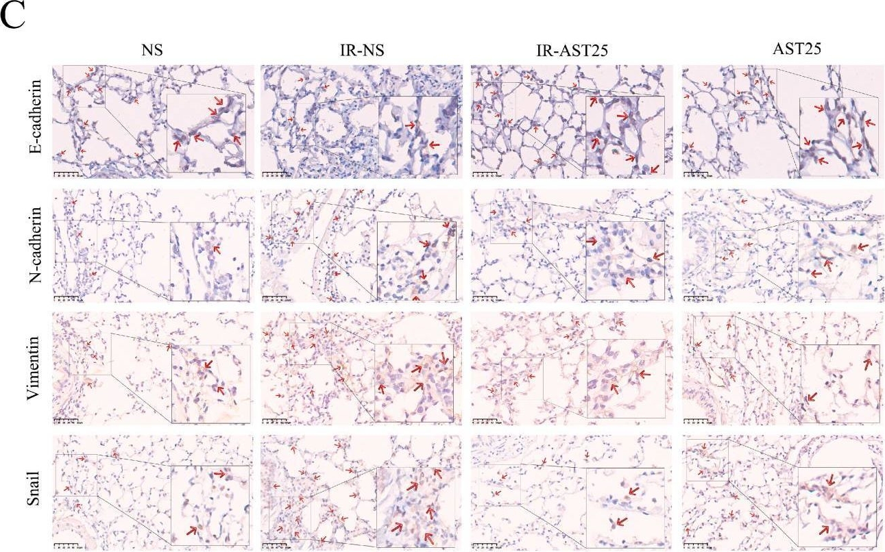 Fig.4.C showing Immunohistochemistry in a Mus musculus (House mouse) sample from the publication: Astilbin Alleviates Radiation-Induced Pulmonary Fibrosis via circPRKCE Targeting the TGF-β/Smad7 Pathway to Inhibit Epithelial-Mesenchymal Transition.