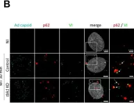Fig.7.B showing Immunocytochemistry-immunofluorescence in a Homo sapiens (Human) sample from the publication: TBK1 is part of a galectin 8 dependent membrane damage recognition complex and drives autophagy upon Adenovirus endosomal escape.