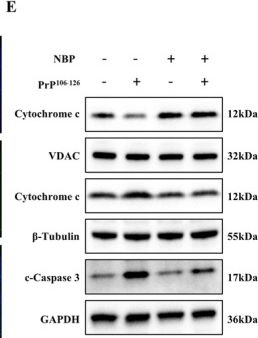 Fig.1.E showing Western Blotting from the publication: DL-3-n-Butylphthalide Protects Against PrP106 -126-Induced Neurotoxicity Through NRF2 Signaling and OPA1/DRP1-Mediated Mitochondrial Dynamics.
