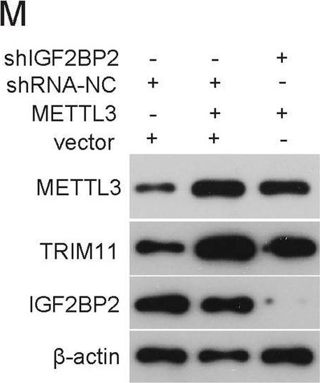 Fig.2.M showing Western Blotting in a Homo sapiens (Human) sample from the publication: TRIM11 facilitates chemoresistance in nasopharyngeal carcinoma by activating the β-catenin/ABCC9 axis via p62-selective autophagic degradation of Daple.