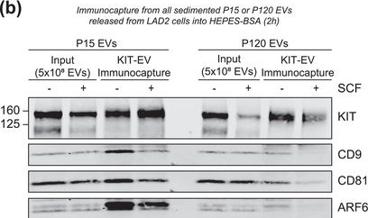 Fig.8.B showing Western Blotting in a Homo sapiens (Human) sample from the publication: Selective immunocapture reveals neoplastic human mast cells secrete distinct microvesicle- and exosome-like populations of KIT-containing extracellular vesicles.