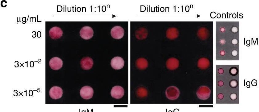 Fig.5.C showing Immunocytochemistry-immunofluorescence in a SARS-CoV-2 sample from the publication: Spike- and nucleocapsid-based gold colloid assay toward the development of an adhesive bandage for rapid SARS-CoV-2 immune response detection and screening.