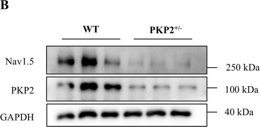 Fig.2.B showing Western Blotting from the publication: Machine learning analysis of ARVC informed by sodium channel protein-based interactome networks.