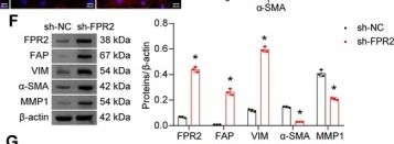 Fig.5.F showing Western Blotting from the publication: Jiawei Danxuan Koukang and Its Component Kaempferol Alleviate Oral Submucous Fibrosis by Restoring Epithelial-Fibroblast Homeostasis and Suppressing Neutrophil Recruitment via the ANXA1/FPR2 Axis.
