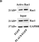 Fig.6.D showing Western Blotting from the publication: PLAC8, a new marker for human interstitial extravillous trophoblast cells, promotes their invasion and migration.