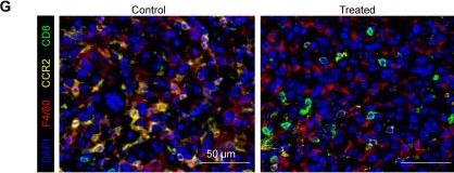 Fig.8.G showing Immunohistochemistry-immunofluorescence from the publication: Targeting tumor-associated CCR2+ macrophages to inhibit pancreatic cancer recurrence following irreversible electroporation.