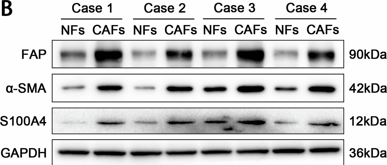 Fig.1.B showing Western Blotting from the publication: NRG1/PDGFC loop between fibroblasts and cancer cells drives paclitaxel resistance via ferroptosis suppression in breast cancer.