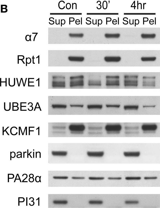 Fig.7.B showing Western Blotting in a Rattus norvegicus (Rat) sample from the publication: Characterization of the Brain 26S Proteasome and its Interacting Proteins.