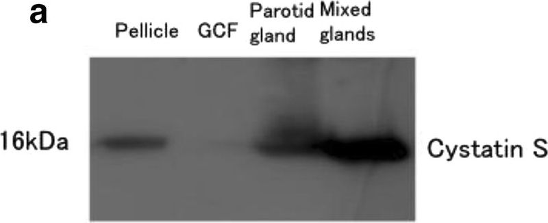 Fig.4.A showing Western Blotting in a Homo sapiens (Human) sample from the publication: Comparison of protein profiles of the pellicle, gingival crevicular fluid, and saliva: possible origin of pellicle proteins.