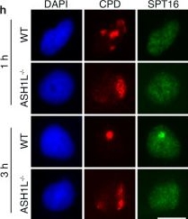 Fig.6.H showing Immunocytochemistry-immunofluorescence from the publication: ASH1L-MRG15 methyltransferase deposits H3K4me3 and FACT for damage verification in nucleotide excision repair.