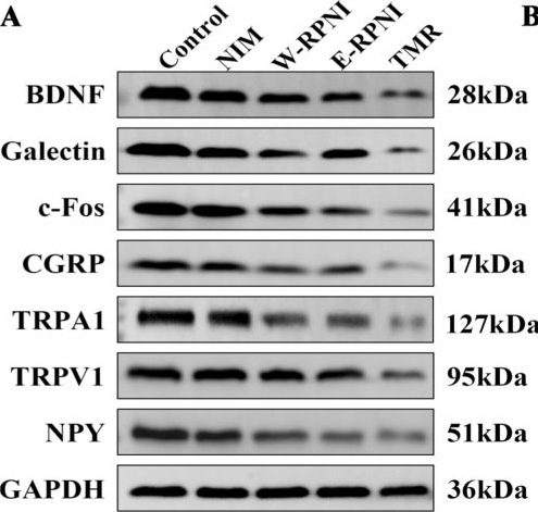 Fig.9.A showing Western Blotting in a Rattus norvegicus (Rat) sample from the publication: Targeted muscle reinnervation attenuates neuropathic pain and neuroma development in a rat model of tibial nerve transection.
