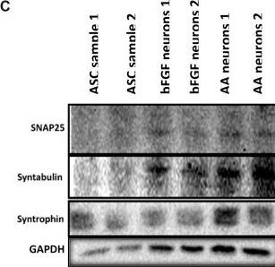 Fig.2.C showing Western Blotting in a Homo sapiens (Human) sample from the publication: Adipose tissue derived stromal cells in a gelatin-based 3D matrix with exclusive ascorbic acid signalling emerged as a novel neural tissue engineering construct: an innovative prototype for soft tissue.