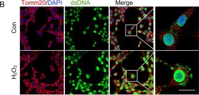 Fig.2.B showing Immunocytochemistry-immunofluorescence in a Mus musculus (House mouse) sample from the publication: STING signaling in vestibular macrophages underlies Ménière's disease pathogenesis.