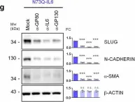 Fig.3.G showing Western Blotting from the publication: Defective N-glycosylation of IL6 induces metastasis and tyrosine kinase inhibitor resistance in lung cancer.