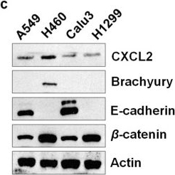 Fig.8.C showing Western Blotting from the publication: Single-cell RNA sequencing for the identification of early-stage lung cancer biomarkers from circulating blood.