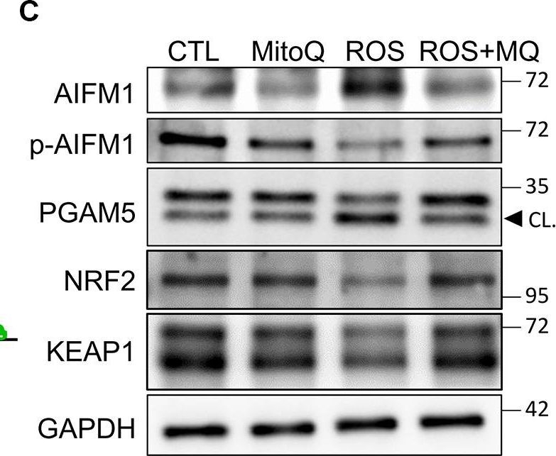 Fig.3.C showing Western Blotting from the publication: Mitoquinone shifts energy metabolism to reduce ROS-induced oxeiptosis in female granulosa cells and mouse oocytes.