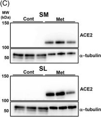 Fig.1.C showing Western Blotting in a Mus musculus (House mouse) sample from the publication: Involvement of metformin and aging in salivary expression of ACE2 and TMPRSS2.