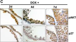 Fig.4.C showing Immunohistochemistry in a Mus musculus (House mouse) sample from the publication: Doxycycline regulated induction of AKT in murine prostate drives proliferation independently of p27 cyclin dependent kinase inhibitor downregulation.