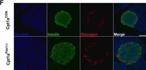 Fig.6.F showing Immunocytochemistry-immunofluorescence in a Mus musculus (House mouse) sample from the publication: Pancreatic expression of CPT1A is essential for whole body glucose homeostasis by supporting glucose-stimulated insulin secretion.