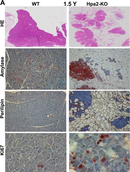 Fig.9.A showing Immunohistochemistry from the publication: Heparanase 2 (Hpa2) protects the exocrine pancreas from damages of Western diet and pancreatic cancer.