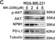 Phospho-Akt (Ser473) (D9E) XP® Rabbit mAb | Cell Signaling
