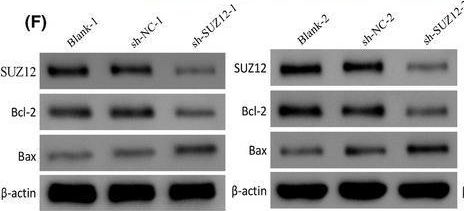 Fig.12.F showing Western Blotting in a Homo sapiens (Human) sample from the publication: The expression and role of SUZ12 in lung adenocarcinoma.