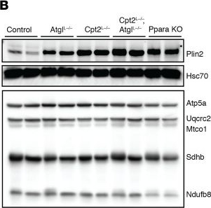 Fig.3.B showing Western Blotting in a Mus musculus (House mouse) sample from the publication: Discordant hepatic fatty acid oxidation and triglyceride hydrolysis leads to liver disease.
